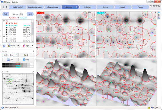 Melanie Classic and DIGE - Software for 2D gel based expression analysis