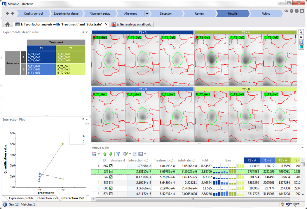 Melanie Classic and DIGE - Software for 2D gel based expression analysis
